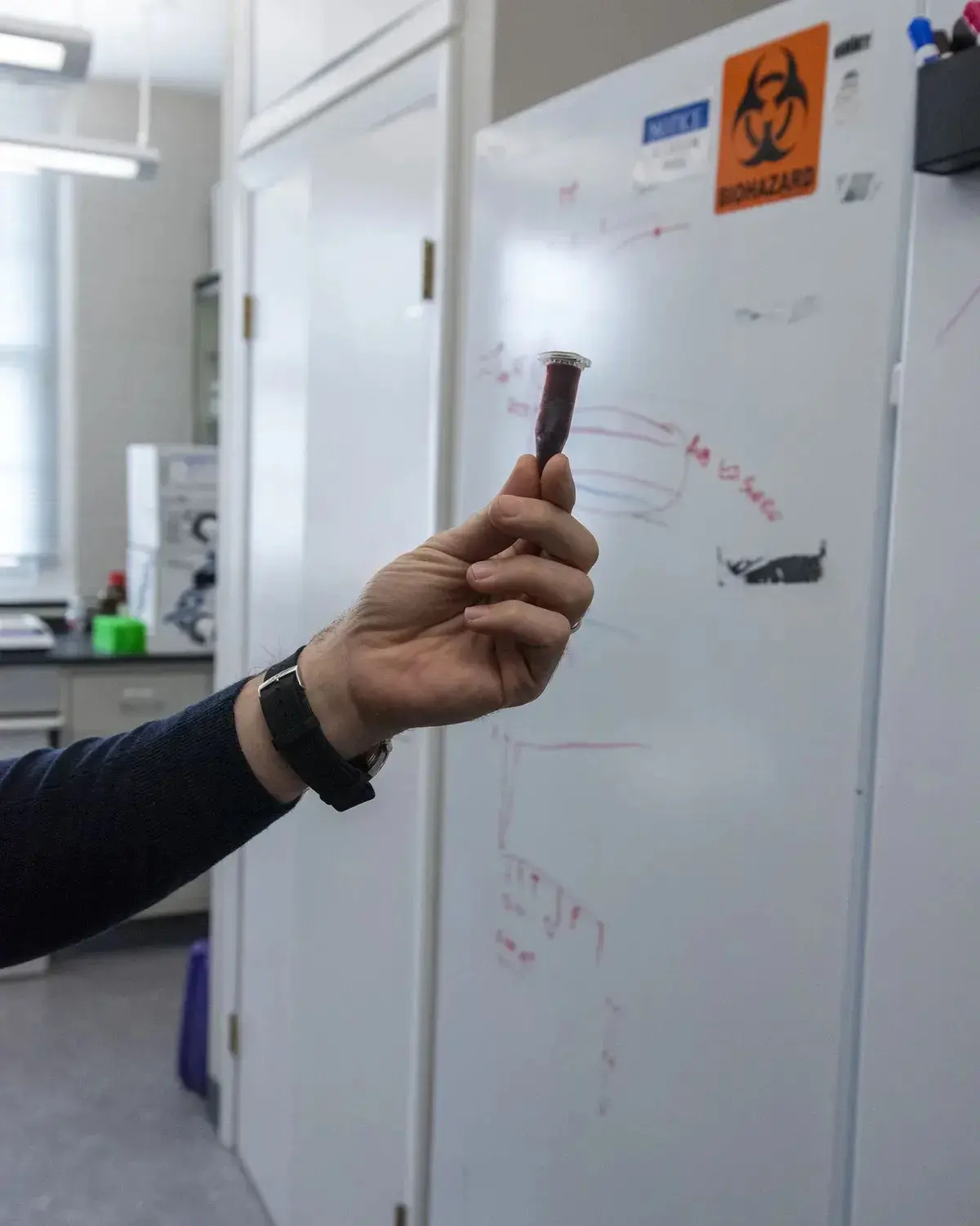 Eight years ago, this crypto billionaire went all in on Ethereum. Why has he become fascinated with longevity science?